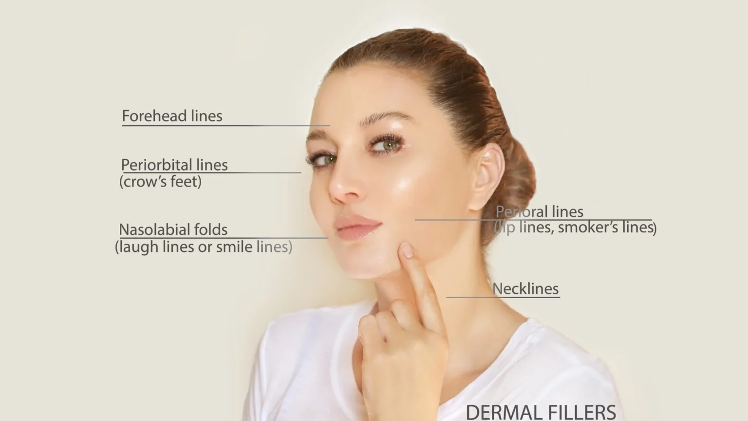 What Areas of the Face Can Be Treated With Fillers?
